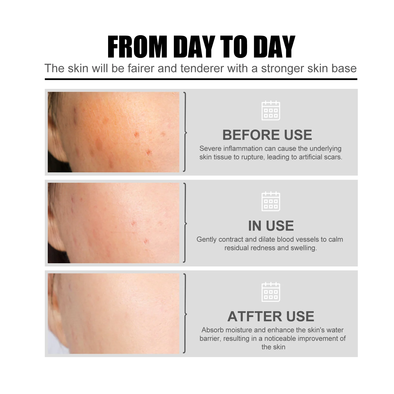Niacinamide Niacinamide Facial Serum: fades acne marks, hydrat - 4