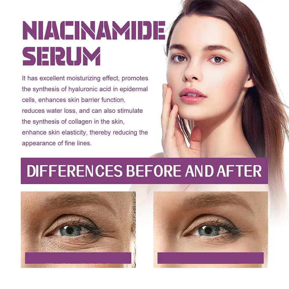 20% Niacinamide B3 Concentrated Serum - Anti-Aging - 2