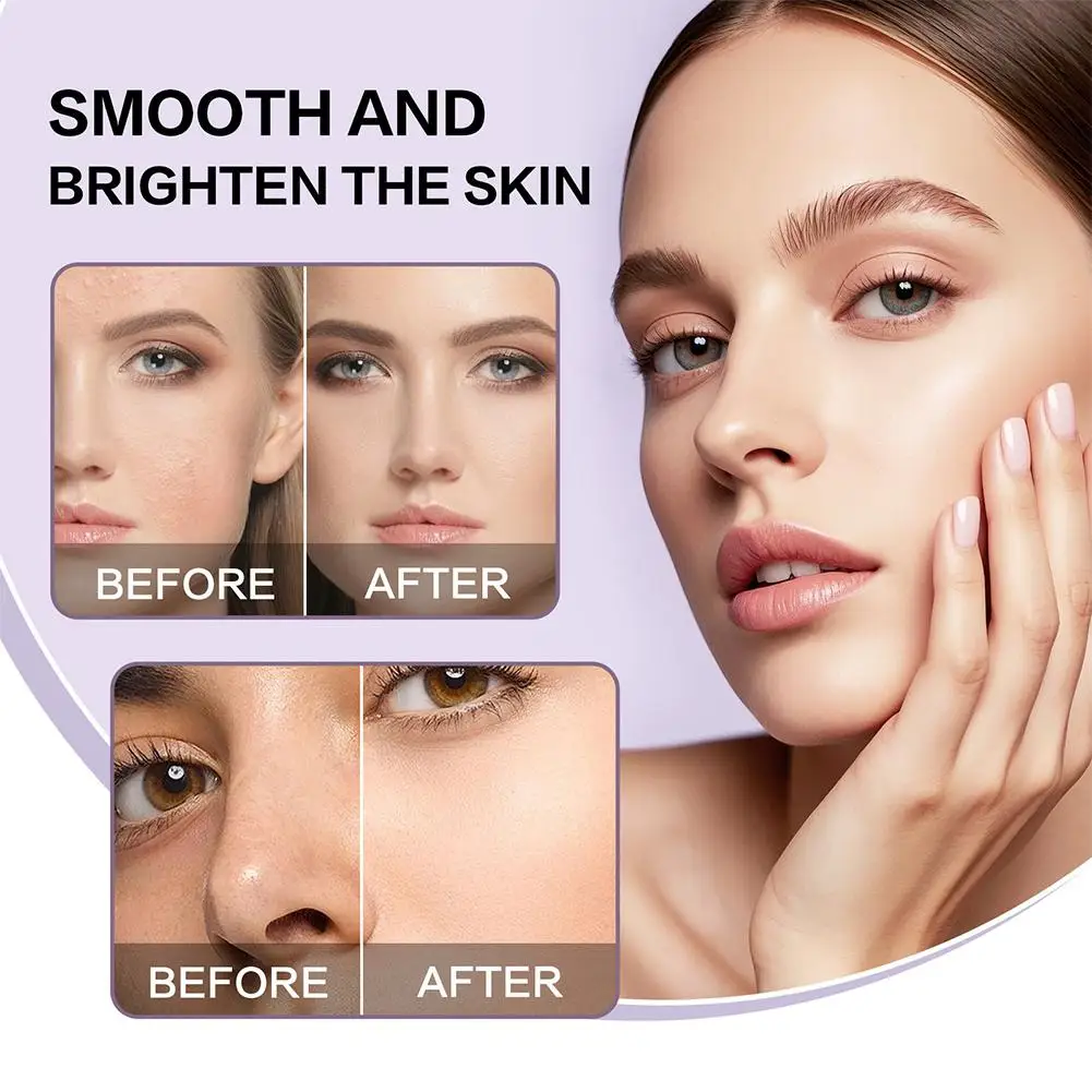 80ML Original Niacinamide Face Serum-dark Spot Cor - 3