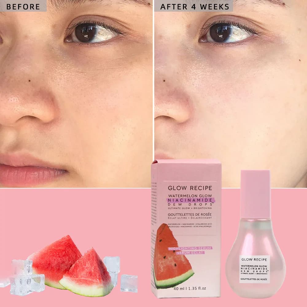 Glow Glow Recipe Watermelon Glow Niacinamide Dew Drops  - 4