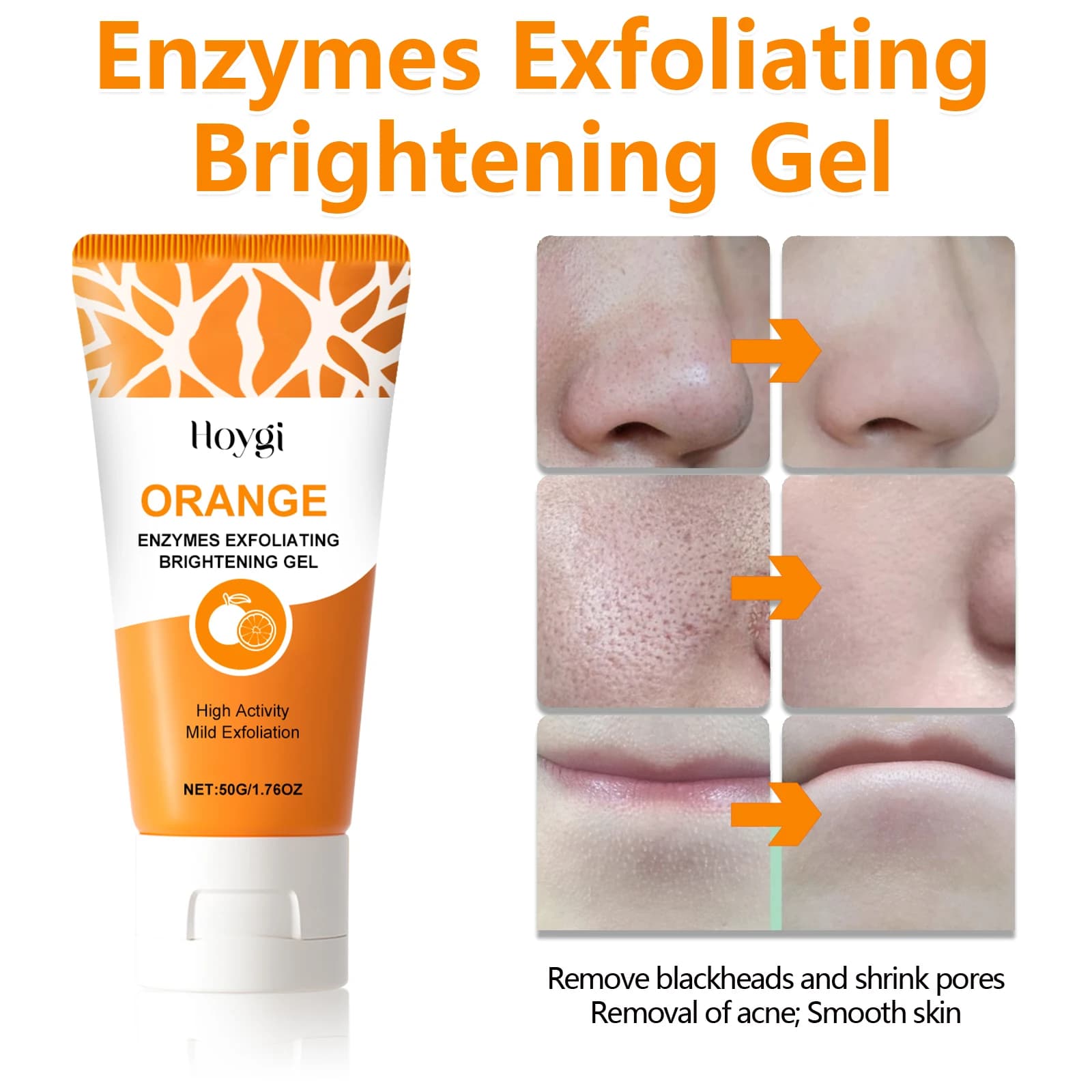 50g Niacinamide Gentle Exfoliating Blackhead Gel P - 4