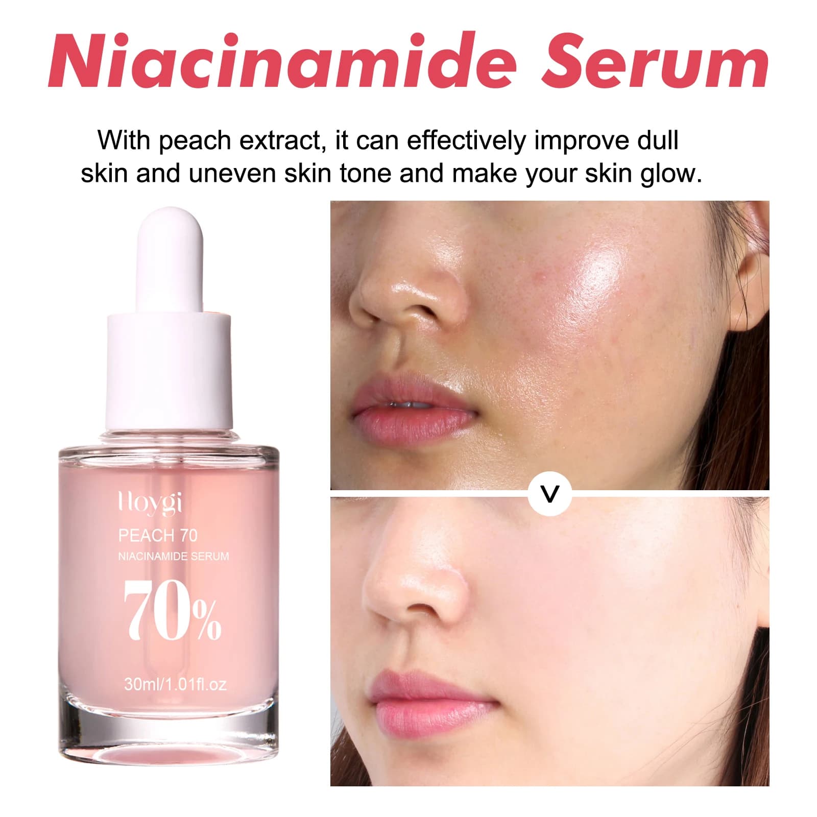 Niacinamide Niacinamide Serum Face Serum Pore Minimizing Brigh - 4